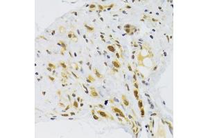Immunohistochemistry of paraffin-embedded human stomach using RPL13 Antibody (ABIN2559760) at dilution of 1:100 (40x lens). (RPL13 抗体)