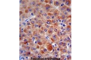 Immunohistochemistry (IHC) image for anti-Complement Factor H (CFH) antibody (ABIN5015561) (Complement Factor H 抗体)