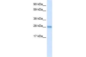Western Blotting (WB) image for anti-BCL2-Like 1 (BCL2L1) antibody (ABIN2463654) (BCL2L1 抗体)