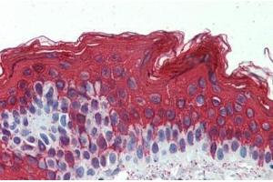 Human Skin: Formalin-Fixed, Paraffin-Embedded (FFPE) (Cytokeratin 1 抗体  (C-Term))