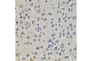 Immunohistochemistry (Paraffin-embedded Sections) (IHC (p)) image for anti-DnaJ (Hsp40) Homolog, Subfamily A, Member 3 (DNAJA3) (AA 221-480) antibody (ABIN6139698)