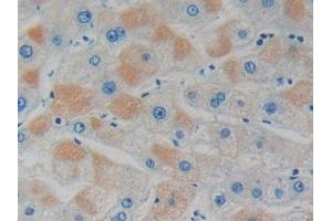 Detection of GDI1 in Human Liver Tissue using Polyclonal Antibody to GDP Dissociation Inhibitor 1 (GDI1) (GDI1 抗体  (AA 1-274))