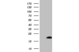 Western Blotting (WB) image for anti-Eukaryotic Translation Initiation Factor 4E Binding Protein 3 (EIF4EBP3) antibody (ABIN2715567) (EIF4EBP3 抗体)