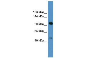 Western Blot showing Lp (a) antibody used at a concentration of 1-2 ug/ml to detect its target protein. (LPA 抗体  (Middle Region))