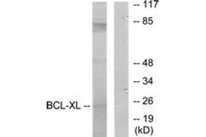Western blot analysis of extracts from 293 cells, treated with UV, using BCL-XL (Ab-62) Antibody. (BCL2L1 抗体  (AA 28-77))