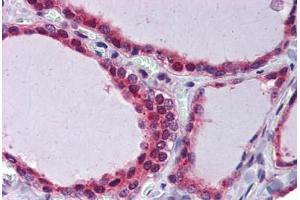 Thyroid, Human: Formalin-Fixed, Paraffin-Embedded (FFPE) (THRSP 抗体)