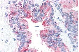 Human Prostate: Formalin-Fixed, Paraffin-Embedded (FFPE) (ADAM20 抗体  (Internal Region))