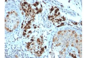 Immunohistochemistry (IHC) image for anti-Steroidogenic Acute Regulatory Protein (STAR) (AA 39-108) antibody (ABIN6940667)