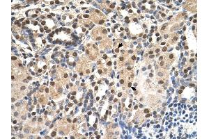 ANP32E antibody was used for immunohistochemistry at a concentration of 4-8 ug/ml to stain EpitheliaI cells of renal tubule (arrows) in Human Kidney. (ANP32E 抗体)