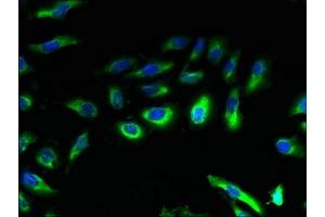 Immunofluorescent analysis of Hela cells using ABIN7145930 at dilution of 1:100 and Alexa Fluor 488-congugated AffiniPure Goat Anti-Rabbit IgG(H+L) (CCR4 抗体  (AA 309-360))