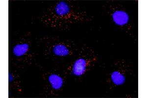 Proximity Ligation Analysis of protein-protein interactions between PTK2 and PLCG1. (FAK 抗体  (AA 1-680))