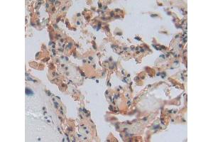 Used in DAB staining on fromalin fixed paraffin- embedded Kidney tissue (LAMC3 抗体  (AA 901-1100))