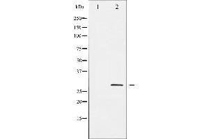Western blot analysis of SNAI1 phosphorylation expression in HT29 whole cell lysates,The lane on the left is treated with the antigen-specific peptide. (SNAIL 抗体  (pSer246))