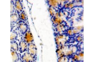 Used in DAB staining on fromalin fixed paraffin-embedded bowels tissue (eIF4EBP1 抗体  (AA 2-117))
