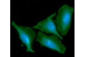 ICC/IF analysis of CKMT1A in HeLa cells line, stained with DAPI (Blue) for nucleus staining and monoclonal anti-human CKMT1A antibody (1:100) with goat anti-mouse IgG-Alexa fluor 488 conjugate (Green). (CKMT1A 抗体)