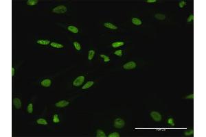 Immunofluorescence of purified MaxPab antibody to SATB1 on HeLa cell. (SATB1 抗体  (AA 1-763))