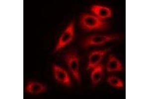 Immunofluorescent analysis of RPLP0 staining in K562 cells. (RPLP0 抗体)