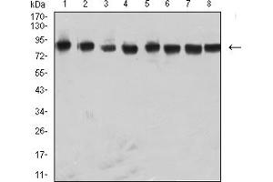 Western Blotting (WB) image for anti-Heterogeneous Nuclear Ribonucleoprotein M (HNRNPM) (AA 17-161) antibody (ABIN7193216)