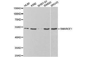 Western Blotting (WB) image for anti-SWI/SNF Related, Matrix Associated, Actin Dependent Regulator of Chromatin, Subfamily E, Member 1 (SMARCE1) antibody (ABIN1876549) (SMARCE1 抗体)