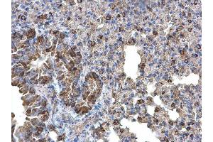 IHC-P Image Monoamine Oxidase B antibody [N2C3] detects Monoamine Oxidase B protein at cytoplasm on mouse lung by immunohistochemical analysis. (Monoamine Oxidase B 抗体)