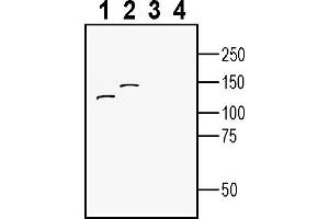 anti-Ectonucleotide Pyrophosphatase/phosphodiesterase 1 (ENPP1) (AA 711-725), (Extracellular) antibody