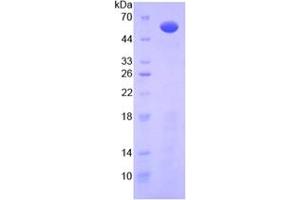 SDS-PAGE analysis of Mouse IL10Ra Protein. (IL-10RA 蛋白)