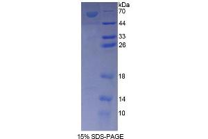 SDS-PAGE analysis of Rat ANKRD1 Protein. (ANKRD1 蛋白)