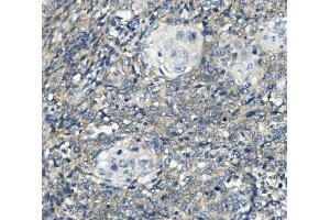 IHC analysis of PHEX using anti-PHEX antibody (ABIN7600072). (PHEX 抗体  (AA 145-718))