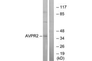 Western Blotting (WB) image for anti-Arginine Vasopressin Receptor 2 (AVPR2) (AA 72-121) antibody (ABIN2891101) (AVPR2 抗体  (AA 72-121))