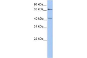 Western Blotting (WB) image for anti-Carbohydrate (Chondroitin 4) Sulfotransferase 13 (CHST13) antibody (ABIN2463257) (CHST13 抗体)