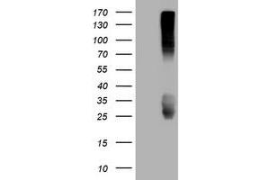 Image no. 3 for anti-CD99 (CD99) antibody (ABIN1497384) (CD99 抗体)