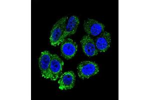 Confocal immunofluorescent analysis of RARS Antibody (C-term) (ABIN655043 and ABIN2844674) with MCF-7 cell followed by Alexa Fluor 488-conjugated goat anti-rabbit lgG (green). (RARS 抗体  (C-Term))