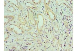 Immunohistochemistry of paraffin-embedded human kidney tissue using ABIN7151645 at dilution of 1:100 (SH3GLB1 抗体  (AA 1-365))