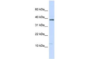 Western Blotting (WB) image for anti-serine Peptidase Inhibitor, Kazal Type 1 (SPINK1) (N-Term) antibody (ABIN2778165)