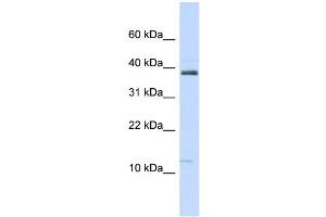 WB Suggested Anti-SPINK1 Antibody Titration:  0. (SPINK1 抗体  (N-Term))
