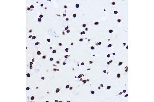 Immunohistochemistry (IHC) image for anti-Histone H1 (AA 1-105) antibody (ABIN1680148)