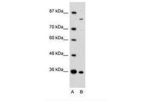 Image no. 1 for anti-Ankyrin Repeat and Zinc Finger Domain Containing 1 (ANKZF1) (AA 106-155) antibody (ABIN6735962) (ANKZF1 抗体  (AA 106-155))