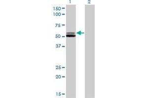 Western Blotting (WB) image for anti-Glutathione Reductase (GSR) (AA 413-523) antibody (ABIN598715) (Glutathione Reductase 抗体  (AA 413-523))