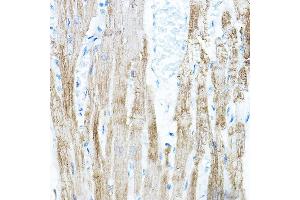Immunohistochemistry of paraffin-embedded rat heart using PDK4 Rabbit pAb (ABIN6132477, ABIN6145396, ABIN6145397 and ABIN6217290) at dilution of 1:100 (40x lens). (PDK4 抗体  (AA 102-411))