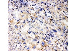 IHC analysis of APOL1 using anti-APOL1 antibody (ABIN7600725). (APOL1 抗体  (AA 228-398))