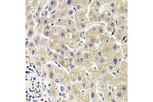 Immunohistochemistry of paraffin-embedded human liver injury using AKT1S1 Antibody (ABIN5973672) at dilution of 1/100 (40x lens). (PRAS40 抗体)