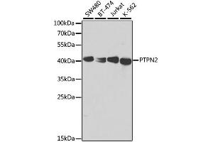 Western blot analysis of extracts of various cell lines, using PTPN2 antibody. (PTPN2 抗体)