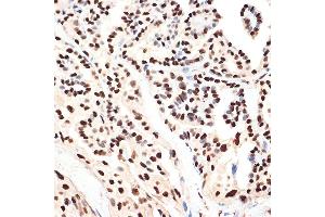 Immunohistochemistry (IHC) image for anti-Acidic (Leucine-Rich) Nuclear phosphoprotein 32 Family, Member B (ANP32B) antibody (ABIN7265377)