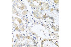 Immunohistochemistry (Paraffin-embedded Sections) (IHC (p)) image for anti-Ribosomal Protein L36 (RPL36) (AA 1-105) antibody (ABIN6147141)
