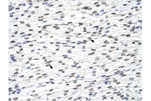 HNRPLL antibody was used for immunohistochemistry at a concentration of 4-8 ug/ml to stain Myocardial cells (arrows) in Human Heart. (HNRPLL 抗体  (N-Term))