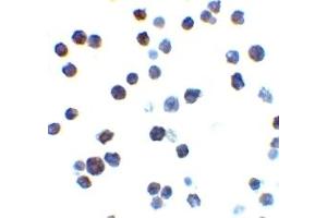 Immunohistochemistry (IHC) image for anti-BCL2-Antagonist/killer 1 (BAK1) (N-Term) antibody (ABIN1031258) (BAK1 抗体  (N-Term))