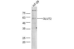 Western Blotting (WB) image for anti-Solute Carrier Family 2 (Facilitated Glucose Transporter), Member 2 (SLC2A2) (AA 482-524) antibody (ABIN739124)
