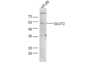 Human HT-29 lysates probed with Rabbit Anti-Glut2 Polyclonal Antibody, Unconjugated  at 1:5000 for 90 min at 37˚C. (SLC2A2 抗体  (AA 482-524))