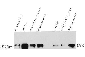 Western Blot analysis of various samples using MAP2 Polyclonal Antibody at dilution of 1:1000. (MAP2 抗体)