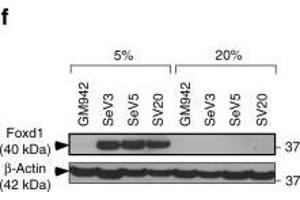 MICU1 is transcriptionally regulated by Foxd1 under hypoxia. (FOXD1 抗体  (C-Term))